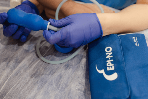 Epino en el masaje perineal epino masaje perineal