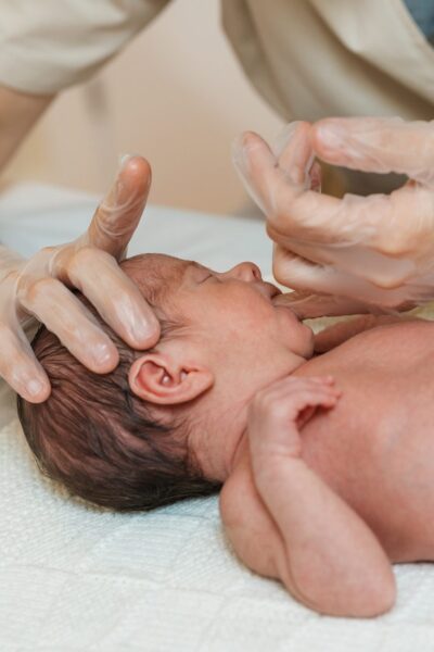 fisioterapia-orofacial-bebes-3 fisioterapia-orofacial-bebes-3